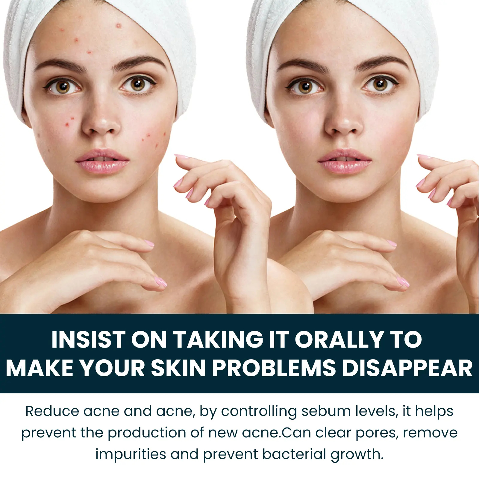 Googeer Acne Drops - Hydrating Skin Supplement for Clear Skin 14 googeer acne drops deep hydrating GOH02 A002 30 GN1 3349