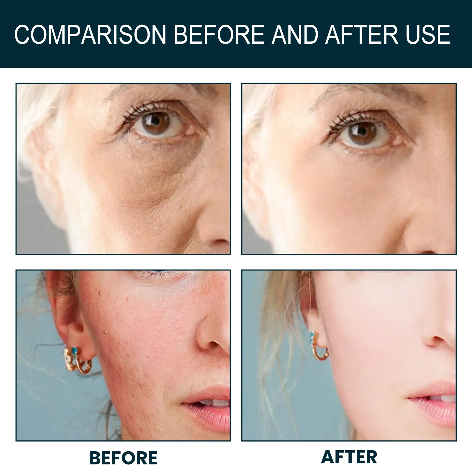 Googeer Acne Drops - Hydrating Skin Supplement for Clear Skin 15 googeer acne drops deep hydrating GOH02 A002 30 GN1 3350