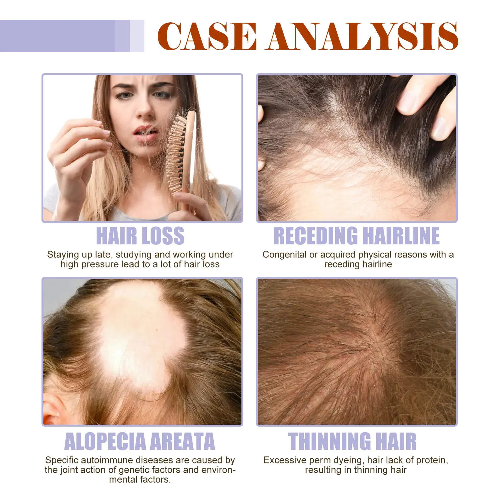 Hair Density Supplement for Thicker, Shinier Hair Support 13 googeer dense hair supplement hair loss GOH02 A030 30 WH1 4338