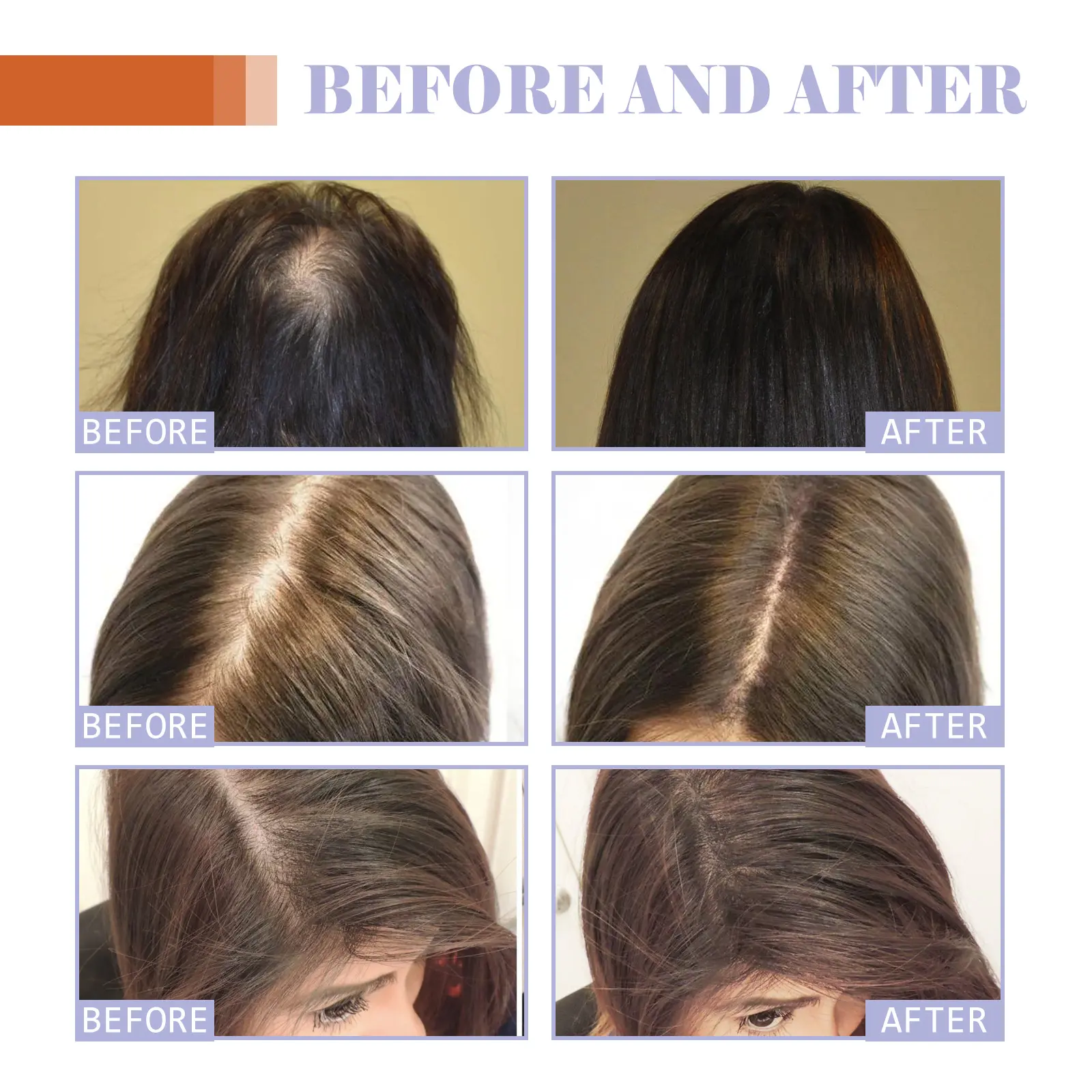 Hair Density Supplement for Thicker, Shinier Hair Support 14 googeer dense hair supplement hair loss GOH02 A030 30 WH1 4345