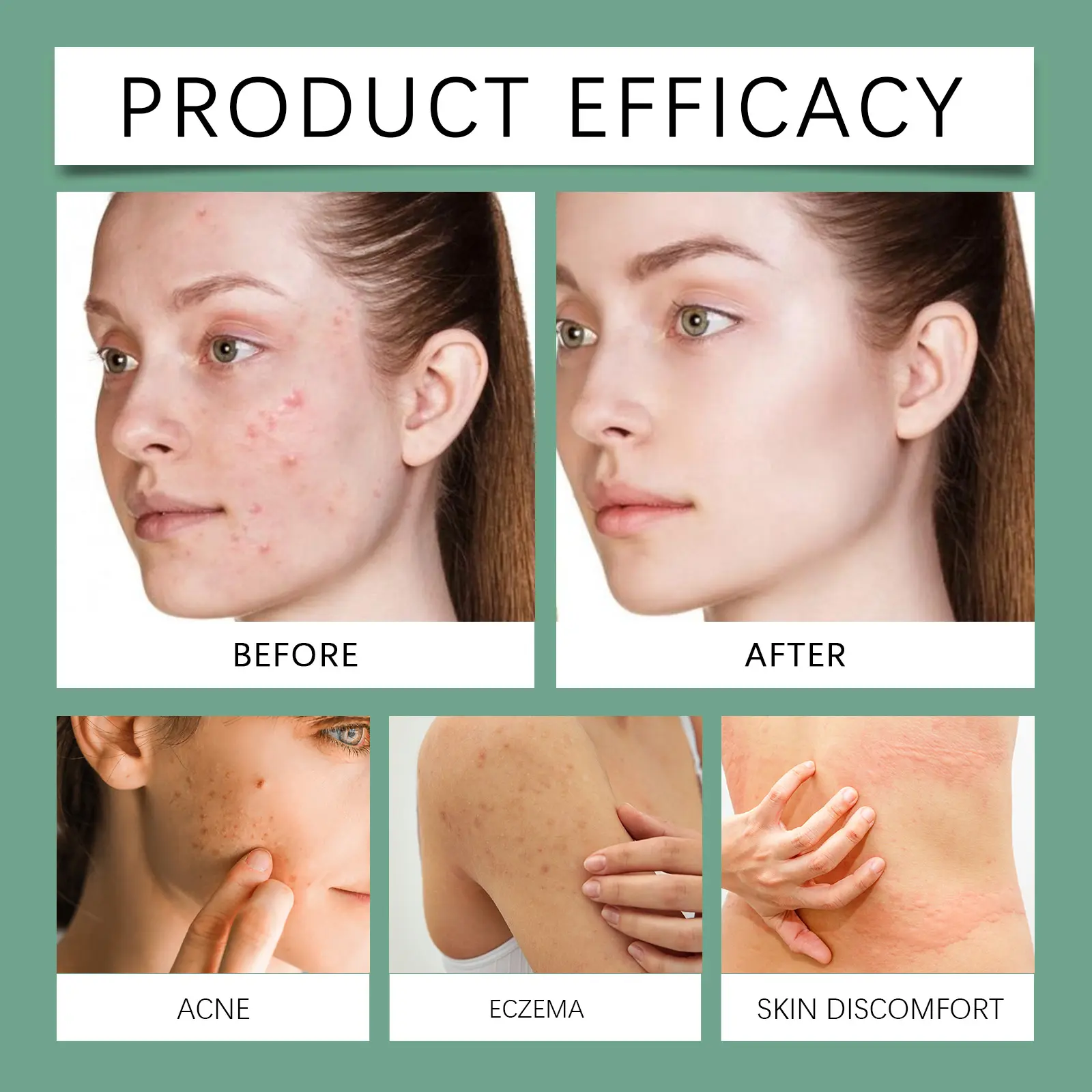 Eczema Herbal Drops for Natural Skin Support 15 googeer eczema herbal drops body GO I03 0008 01 4232