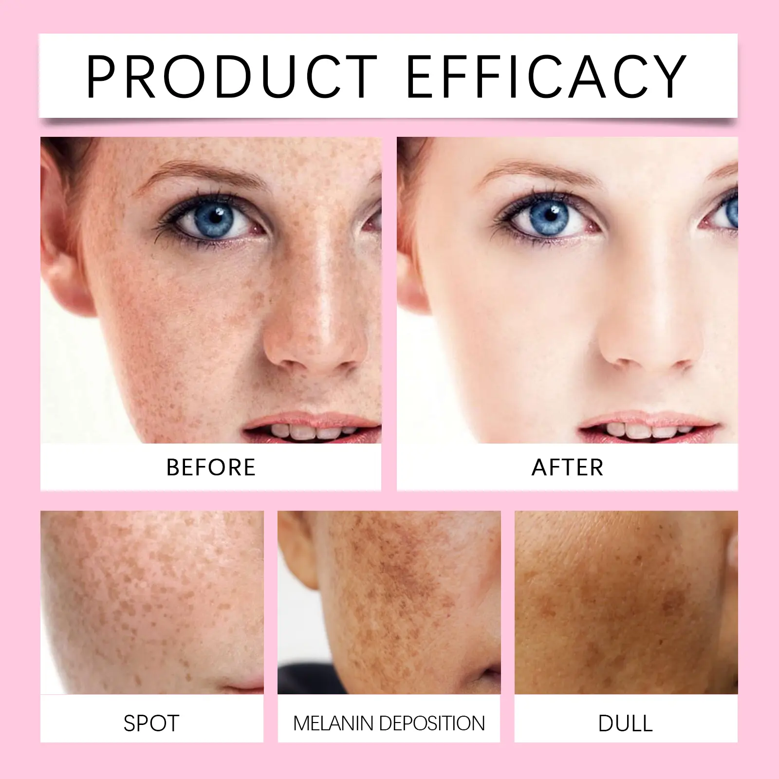 Freckle & Dark Spot Whitening Capsules with Vitamin C - Googeer 15 googeer freckle whitening capsule GOB07 A019 60 PK1 2159