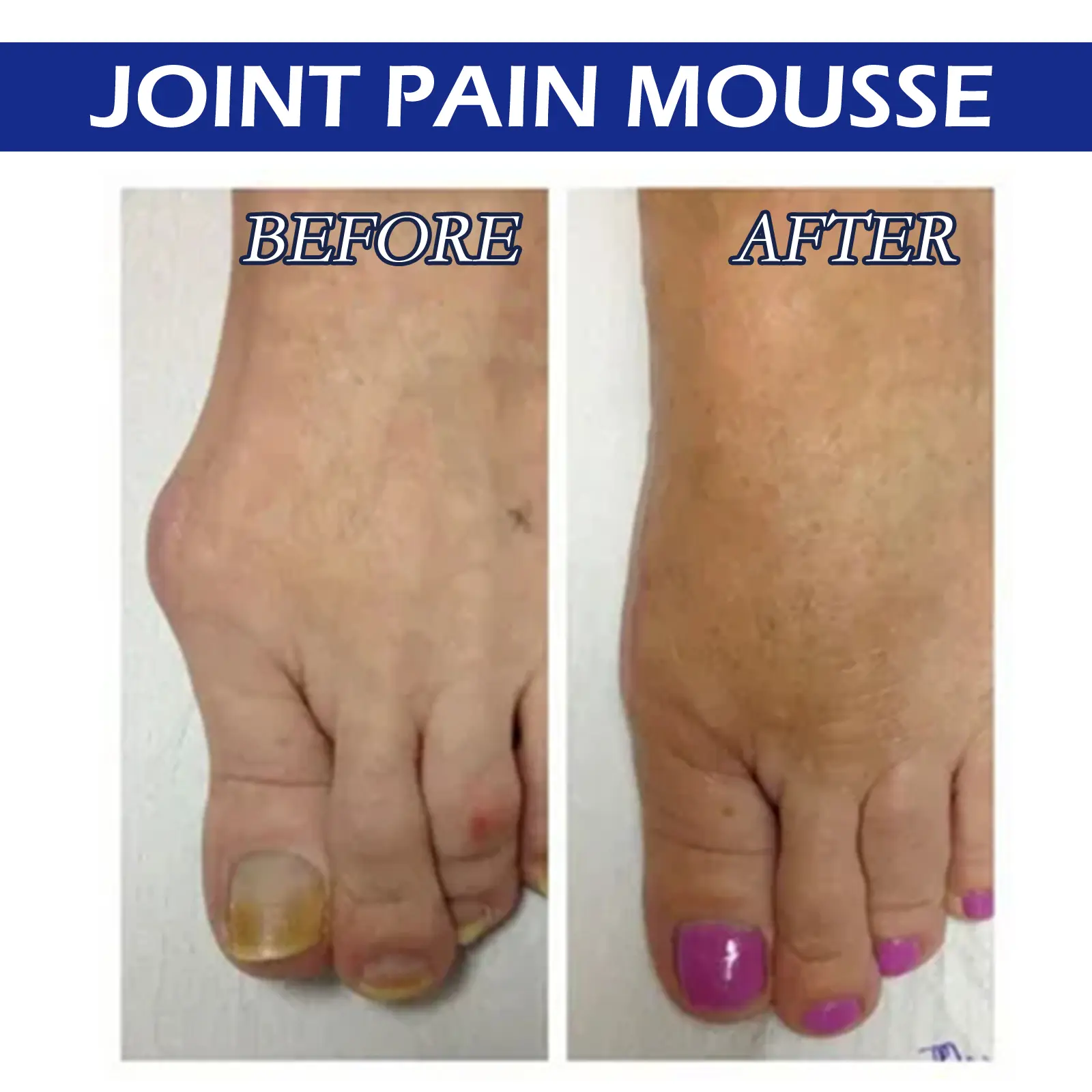 Herbal Care Drops for Joint and Body Support 14 googeer herbal care drops sore joints GOA08 A003 15 BU1 3976