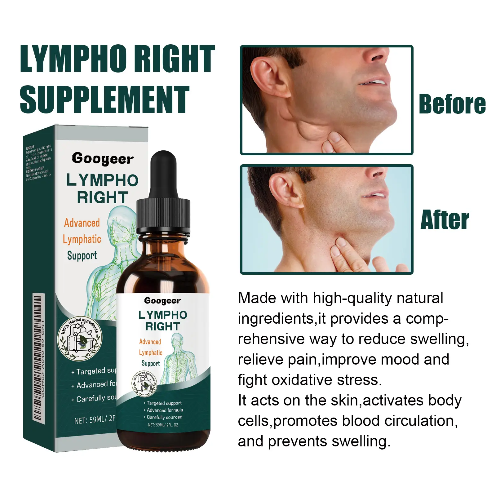 Herbal Supplement Drops for Lymphatic Support and Wellness 14 googeer herbal supplements lymphatic swelling GOH02 A040 59 GN1 4301