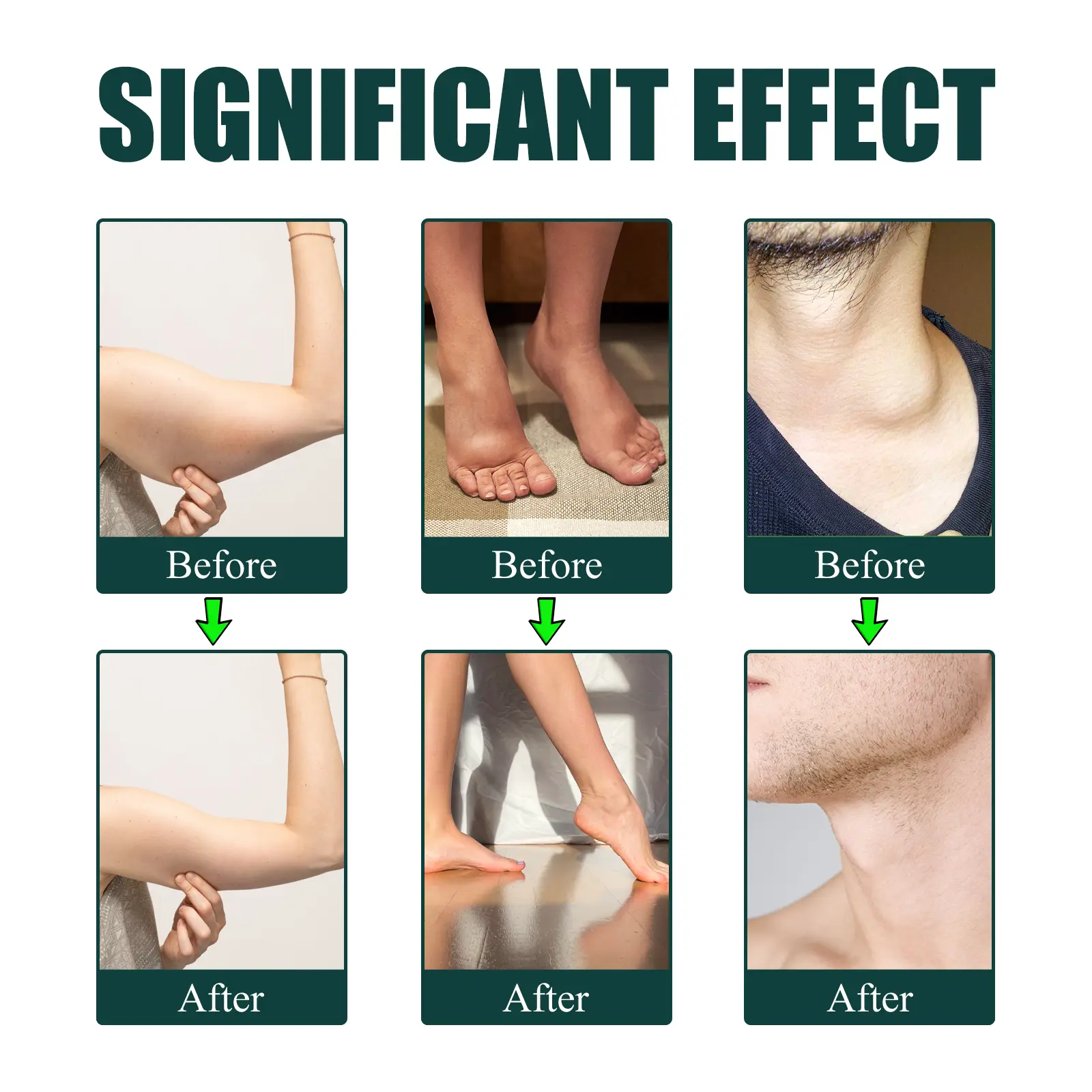 Herbal Supplement Drops for Lymphatic Support and Wellness 15 googeer herbal supplements lymphatic swelling GOH02 A040 59 GN1 4302