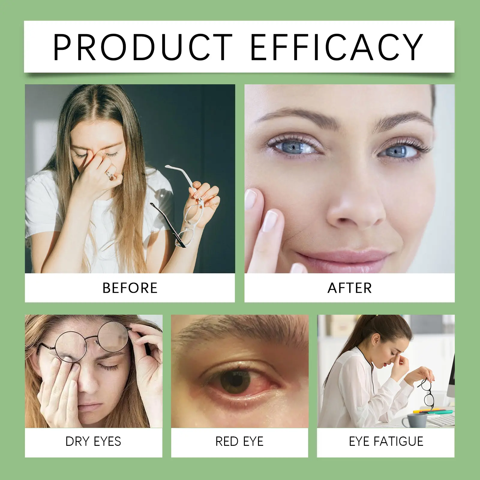 Vision Relief Herbal Capsules - Eye Care Support 15 googeer vision relief capsules herbal GO I02 0197 01 4518